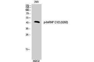 Western Blotting (WB) image for anti-Heterogeneous Nuclear Ribonucleoprotein C (C1/C2) (HNRNPC) (pSer260) antibody (ABIN3173285) (HNRNPC anticorps  (pSer260))