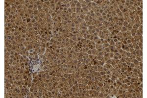 ABIN6278237 at 1/100 staining Rat liver tissue by IHC-P. (S100A2 anticorps)