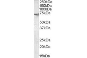 Western Blotting (WB) image for anti-Acetylcholinesterase (AChE) (C-Term) antibody (ABIN2465345) (Acetylcholinesterase anticorps  (C-Term))
