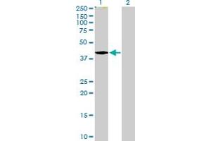 Western Blot analysis of TMOD2 expression in transfected 293T cell line by TMOD2 MaxPab polyclonal antibody. (TMOD2 anticorps  (AA 1-351))