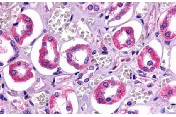 TAAR6 anticorps  (Cytoplasmic Domain)