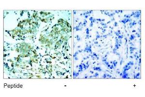 Image no. 1 for anti-Epidermal Growth Factor Receptor (EGFR) (Tyr1110) antibody (ABIN197516) (EGFR anticorps  (Tyr1110))