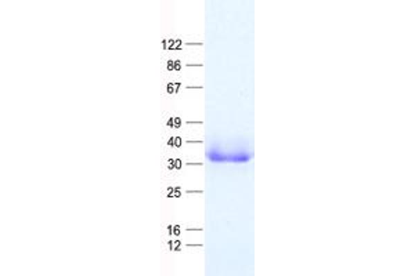 AEBP2 Protein (His tag)