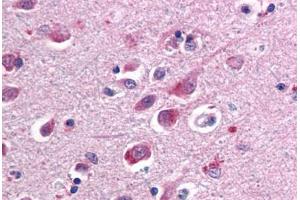 Human Brain, Cortex (formalin-fixed, paraffin-embedded) stained with SARM1 antibody ABIN461750 at 10 ug/ml followed by biotinylated anti-mouse IgG secondary antibody ABIN481714, alkaline phosphatase-streptavidin and chromogen. (SARM1 anticorps  (AA 93-292))