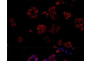 Immunofluorescence analysis of HeLa cells using CD40L Polyclonal Antibody at dilution of 1:100. (CD40 Ligand anticorps)