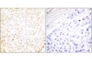 Immunohistochemistry (IHC) image for anti-X-Ray Repair Complementing Defective Repair in Chinese Hamster Cells 5 (Double-Strand-Break Rejoining) (XRCC5) (AA 683-732) antibody (ABIN2889296) (XRCC5 anticorps  (AA 683-732))
