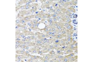 Immunohistochemistry of paraffin-embedded human liver injury using DFNA5 antibody (ABIN5975144) at dilution of 1/100 (40x lens). (DFNA5 anticorps)