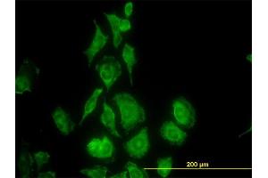 Immunofluorescence of monoclonal antibody to TIMP2 on HeLa cell. (TIMP2 anticorps  (AA 27-220))
