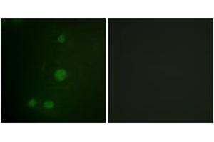 Immunofluorescence (IF) image for anti-Retinoblastoma Protein (Rb Protein) (AA 771-820) antibody (ABIN2888773) (Retinoblastoma Protein (Rb) anticorps  (AA 771-820))