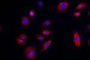 Immunofluorescence (IF) image for anti-Cadherin 5 (CDH5) antibody (Alexa Fluor 594) (ABIN2656818) (Cadherin 5 anticorps  (Alexa Fluor 594))