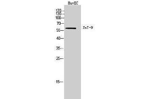 Western Blotting (WB) image for anti-Solute Carrier Family 30 (Zinc Transporter), Member 9 (SLC30A9) (Internal Region) antibody (ABIN3180953) (SLC30A9 anticorps  (Internal Region))