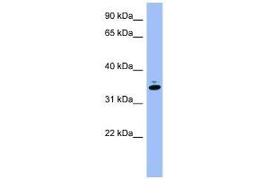 GAPDH antibody used at 1 ug/ml to detect target protein. (GAPDH anticorps  (Middle Region))