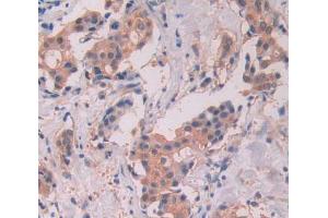 Used in DAB staining on fromalin fixed paraffin- embedded Kidney tissue (STAT5A anticorps  (AA 586-688))