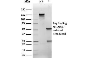 SDS-PAGE Analysis Purified p21 Recombinant Mouse Monoclonal Antibody (rCIP1/6907). (Recombinant p21 anticorps  (AA 1-100))