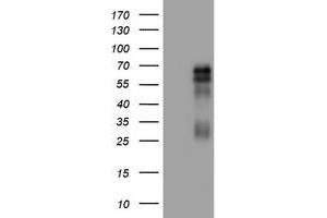 Image no. 1 for anti-Tumor Necrosis Factor Receptor Superfamily, Member 8 (TNFRSF8) (AA 19-379) antibody (ABIN1491091) (TNFRSF8 anticorps  (AA 19-379))