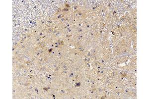 Immunohistochemistry analysis of paraffin-embedded mouse spinal marrow using NOS2 Polyclonal Antibody at dilution of 1:500. (NOS2 anticorps)