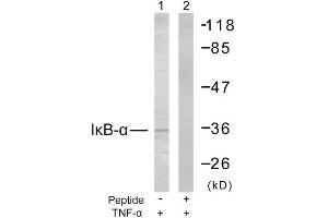 Western Blotting (WB) image for anti-Nuclear Factor of kappa Light Polypeptide Gene Enhancer in B-Cells Inhibitor, alpha (NFKBIA) (Ser32), (Ser36) antibody (ABIN1848117) (NFKBIA anticorps  (Ser32, Ser36))