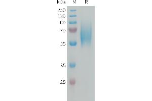 FGFR2 Protein (AA 22-374) (His tag)