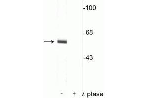 Western blot of rat cortical lysate showing specific immunolabeling of the ~62 kDa synaptotagmin phosphorylated at Thr202 in the first lane (-). (SYT1 anticorps  (pThr202))