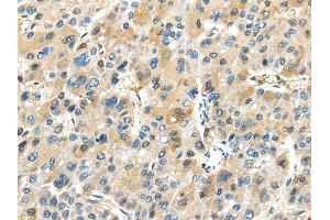 Immunohistochemistry (IHC) image for anti-TRAF Interacting Protein (TRAIP) antibody (ABIN5957748) (TRAIP anticorps)