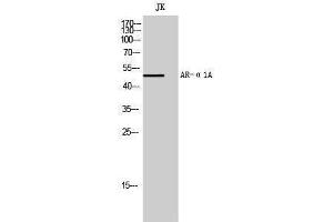 Western Blotting (WB) image for anti-Adrenoceptor alpha 1A (ADRA1A) (Internal Region) antibody (ABIN6280848) (alpha 1 Adrenergic Receptor anticorps  (Internal Region))