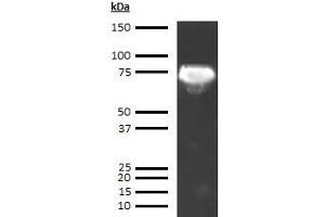 Western Blotting (WB) image for anti-alpha-Fetoprotein (AFP) antibody (ABIN613541) (alpha Fetoprotein anticorps)