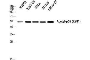 Western Blot (WB) analysis of HepG2 293T-UV HeLa AD293 HeLa-UV using Acetyl-p53 (K381) Polyclonal Antibody. (p53 anticorps  (acLys381))