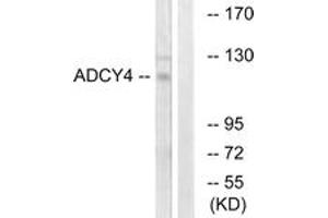 Western Blotting (WB) image for anti-Adenylate Cyclase 4 (ADCY4) (AA 195-244) antibody (ABIN2889852) (ADCY4 anticorps  (AA 195-244))