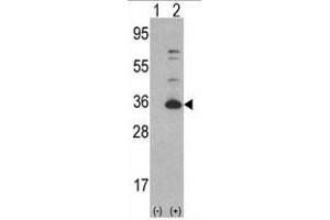 Western Blotting (WB) image for anti-Cyclin-Dependent Kinase 4 (CDK4) (AA 273-305), (C-Term) antibody (ABIN391751)