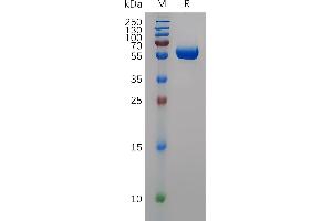 Human , His Tag on SDS-PAGE under reducing condition. (MMP 9 Protein (AA 20-469) (His tag))