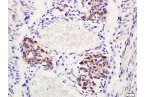 Formalin-fixed and paraffin embedded mouse emrbyo labeled with Rabbit Anti-Delta 4 Polyclonal Antibody, Unconjugated (ABIN761606) at 1:200 followed by conjugation to the secondary antibody and DAB staining (DLL4 anticorps  (AA 551-650))