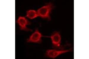 ABIN6266551 staining HuvEc by IF/ICC. (GRM7 anticorps  (C-Term))