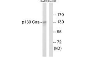 Western Blotting (WB) image for anti-Breast Cancer Anti-Estrogen Resistance 1 (BCAR1) (AA 376-425) antibody (ABIN2888602) (BCAR1 anticorps  (AA 376-425))