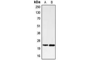 Western blot analysis of PUMA expression in K562 (A), U937 (B) whole cell lysates. (PUMA anticorps  (C-Term))