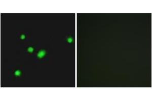 Immunofluorescence analysis of A549 cells, using MUTYH Antibody. (MUTYH anticorps  (AA 151-200))