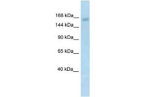 WB Suggested Anti-Utx Antibody   Titration: 1. (KDM6A anticorps  (N-Term))