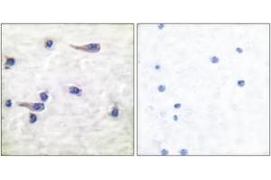Immunohistochemistry analysis of paraffin-embedded human brain, using Tau (Phospho-Thr212) Antibody. (tau anticorps  (pThr529))