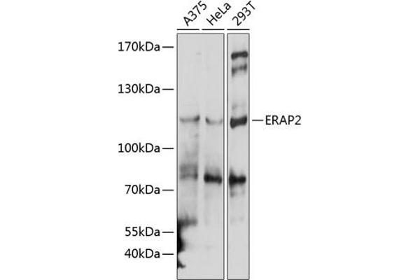 ERAP2 anticorps  (AA 1-170)