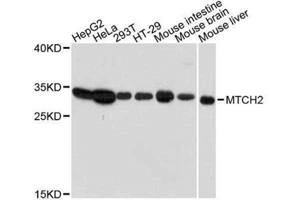 MTCH2 anticorps  (AA 30-175)