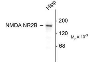 Image no. 1 for anti-Glutamate Receptor, Ionotropic, N-Methyl D-Aspartate 2B (GRIN2B) (C-Term) antibody (ABIN305791) (GRIN2B anticorps  (C-Term))