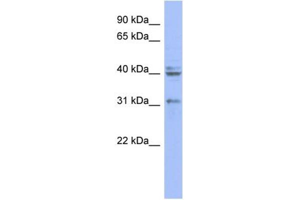 PABPN1 anticorps  (N-Term)