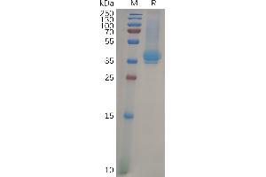 Human CD23 Protein, His Tag on SDS-PAGE under reducing condition. (FCER2 Protein (AA 48-321) (His tag))