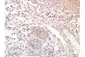 Immunohistochemistry (Paraffin-embedded Sections) (IHC (p)) image for anti-Leukotriene B4 Receptor (LTB4R) (AA 101-200) antibody (ABIN748628)