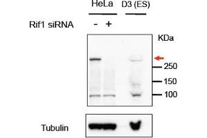 Western Blotting (WB) image for anti-RAP1 Interacting Factor Homolog (RIF1) (AA 2432-2444) antibody (ABIN1103996) (RIF1 anticorps  (AA 2432-2444))