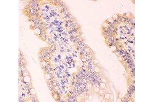 IHC-P staining of rat intestine tissue (MCL-1 anticorps  (AA 1-350))