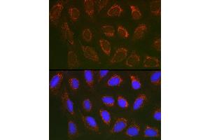 Immunofluorescence analysis of U2OS cells using SLC25 Rabbit pAb (ABIN1682768, ABIN3017839, ABIN3017840 and ABIN6220286) at dilution of 1:100 (40x lens). (SLC25A6 anticorps  (AA 1-298))