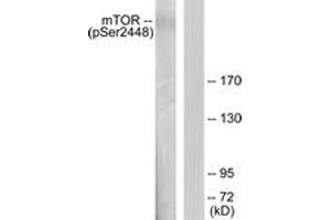 Western Blotting (WB) image for anti-Mechanistic Target of Rapamycin (serine/threonine Kinase) (mTOR) (pSer2448) antibody (ABIN2888475) (MTOR anticorps  (pSer2448))