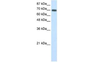 CARS antibody used at 1 ug/ml to detect target protein. (CARS anticorps  (N-Term))