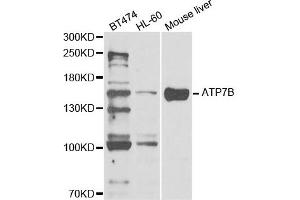 Western Blotting (WB) image for anti-ATPase, Cu++ Transporting, beta Polypeptide (ATP7B) antibody (ABIN1876877) (ATP7B anticorps)