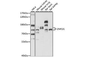 Western blot analysis of extracts of various cell lines, using ZNF131 antibody. (ZNF131 anticorps)